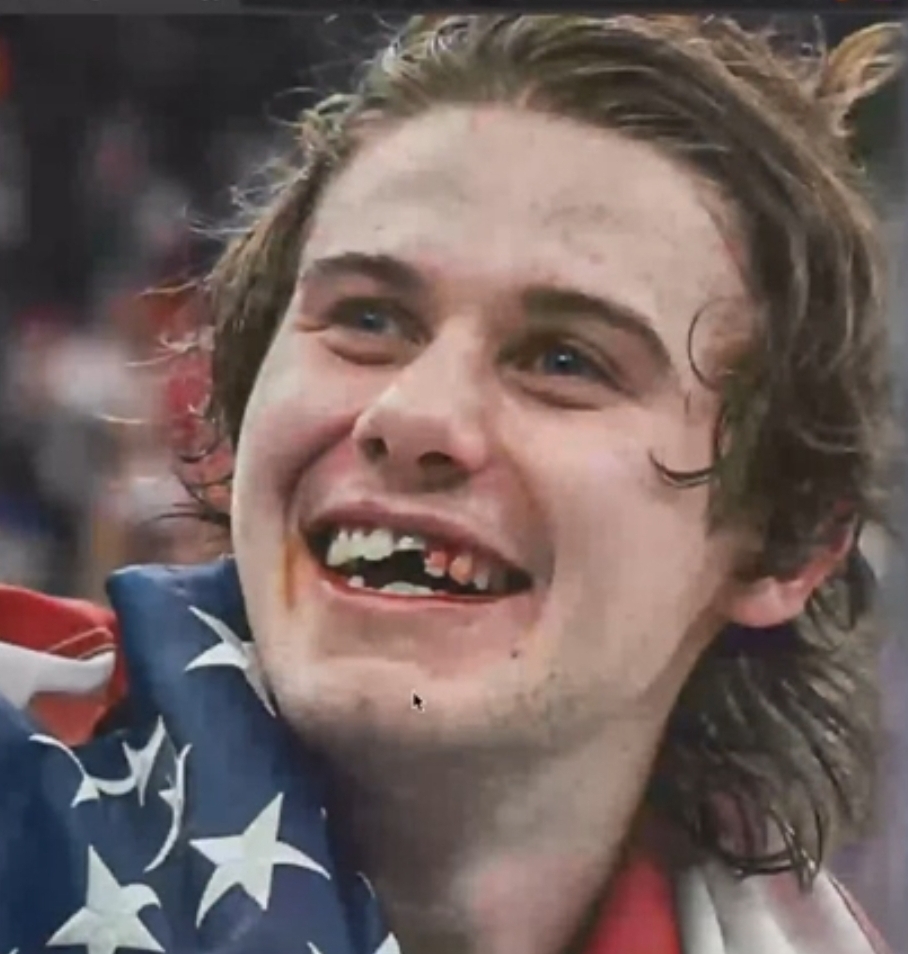 Best gold medal moment ever!  
Broken, bleeding and has never been happier in his life.